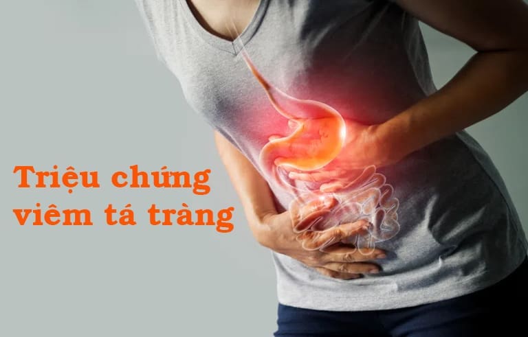 Viêm tá tràng: Triệu chứng nguyên nhân và 3 cách điều trị hiệu quả
